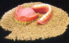 Image of Bulky Dentures, which can impair speech