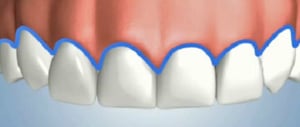Symmetrical Healthy Gums