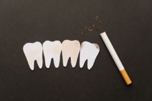 Dental Implants and Smoking: Risks, Effects, and Best Practices